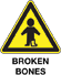 hazard-limb-broken-bone